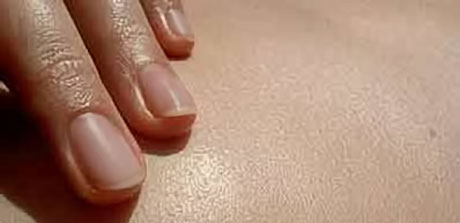 DL-Bild-fingerspitzen_gross2